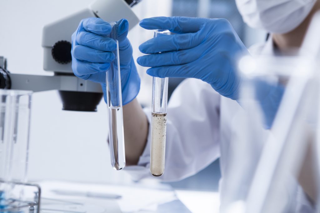 Arıtma Çamuru Analizi Nedir