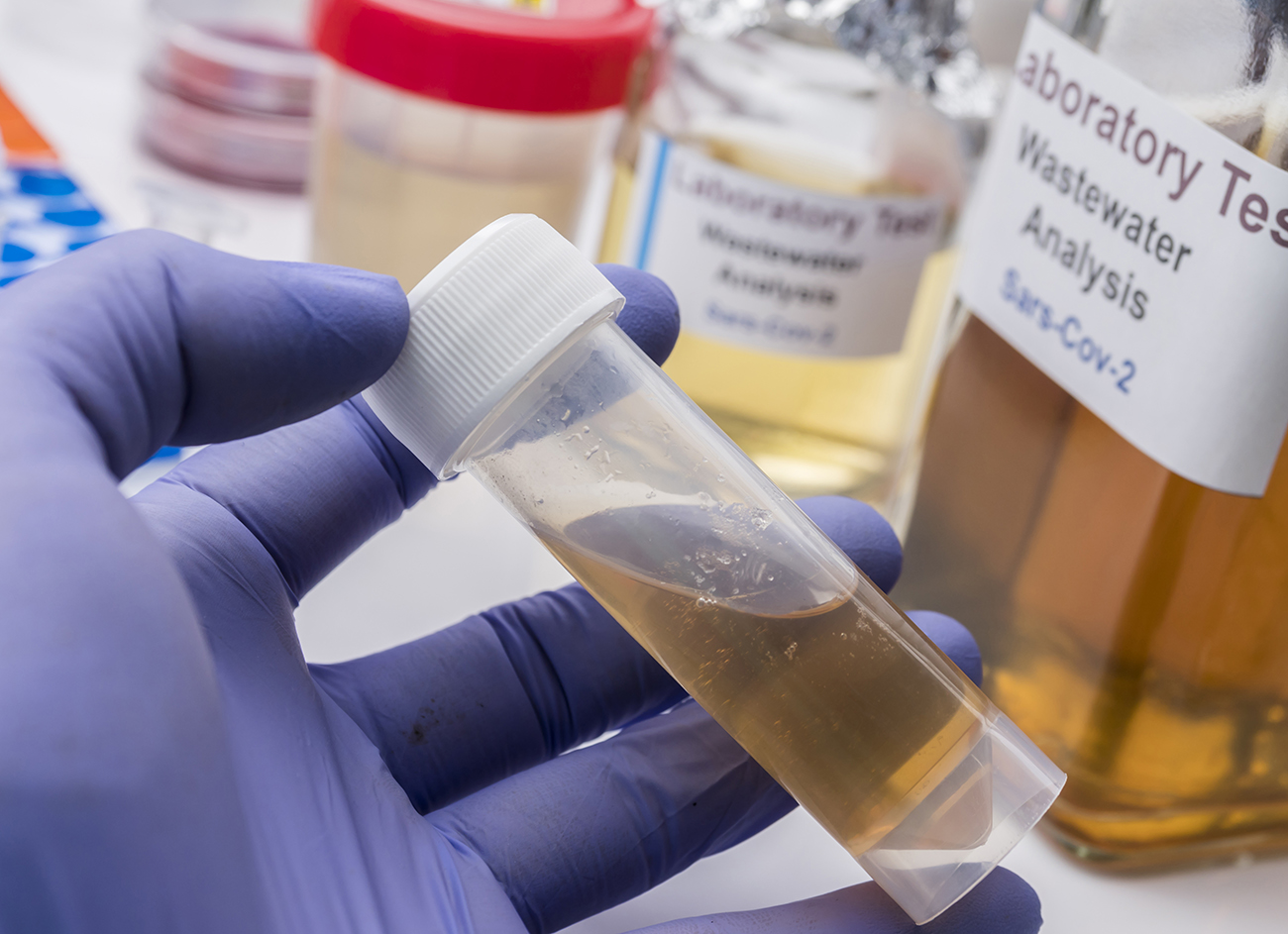 Atıksu BTEX Benzen, Toluen, Etil Benzen, Ksilen Tayini